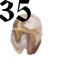 35